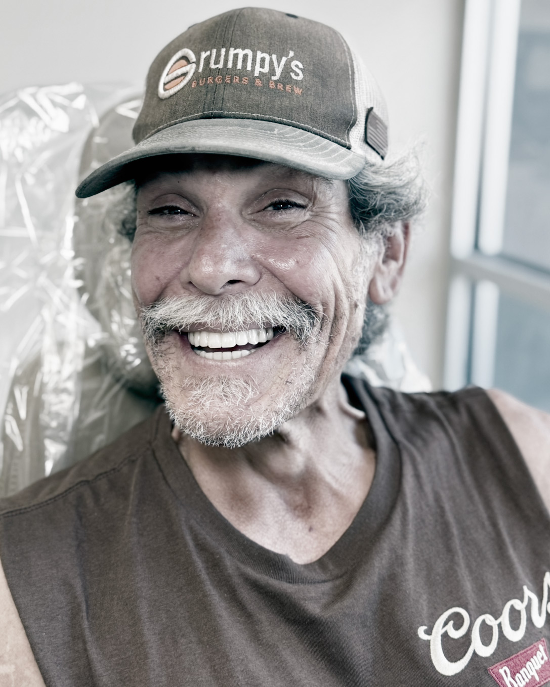 Before and after full arch dental implants transformation